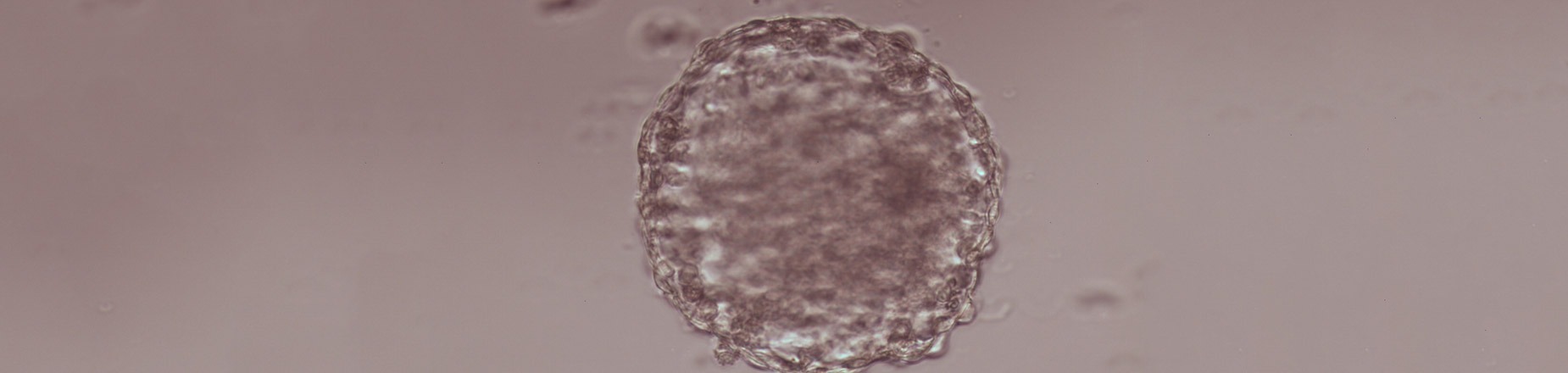Embryotransfer