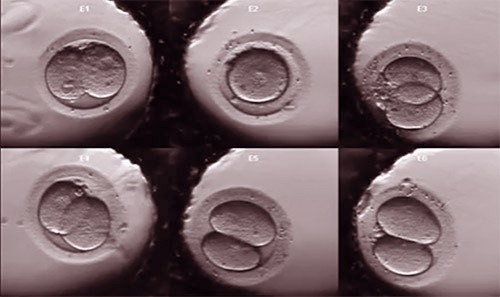Embryo Monitoring System